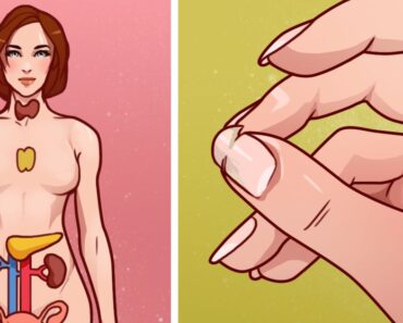 10 ways your body is warning against hormone imbalance
